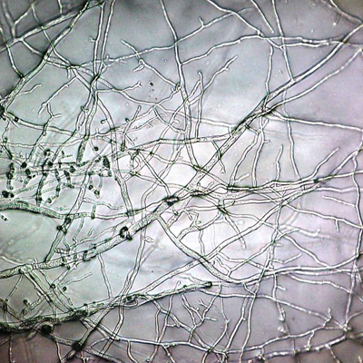 Tree Fungus in South East Queensland